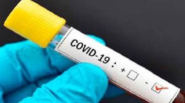 Curuzú Cuatiá: Resultado negativo en muestra de Covid-19